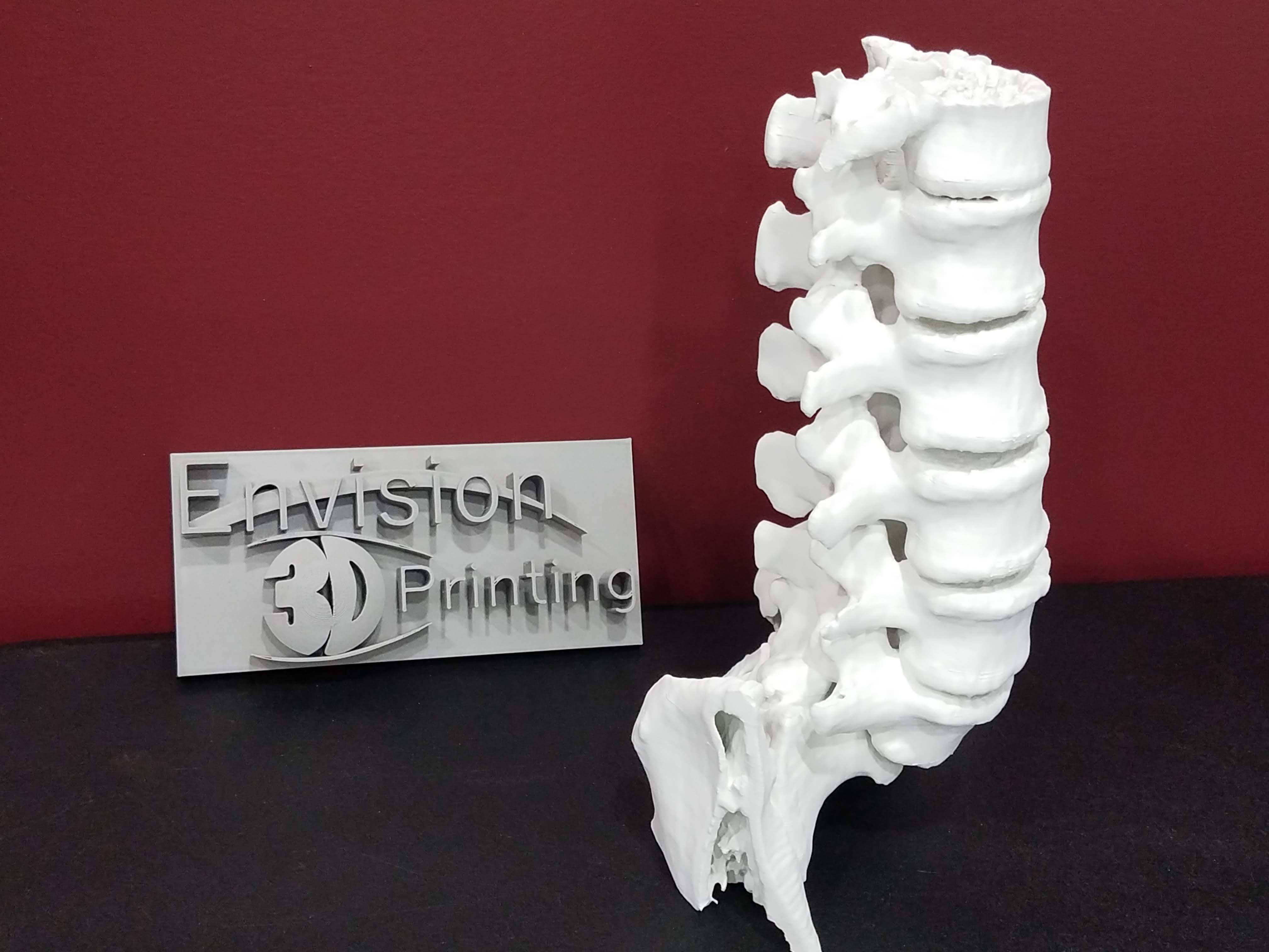 Image of a 3D printed spine created from an MRI