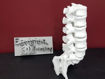 Image of a spine 3D printed from an MRI