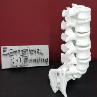 Image of a spine 3D printed from an MRI